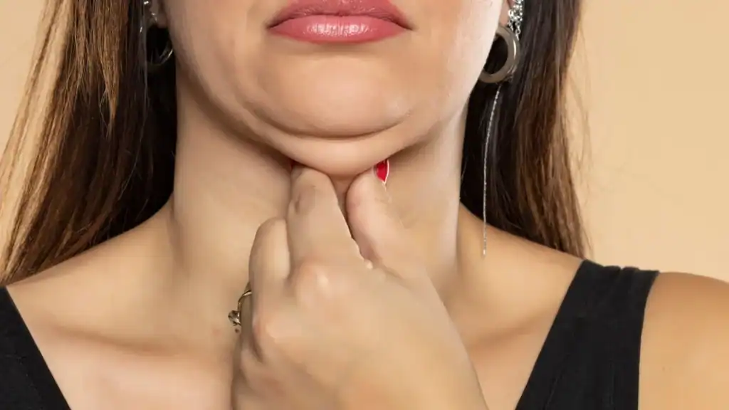 An image of a woman with double chin, sad, worried : Non Surgical Double Chin Removal Treatment in Uttoxeter, UK