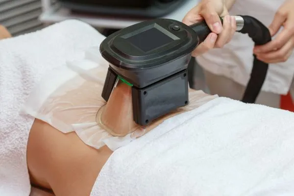 Image of person having fat freezing treatment to help weight gain Uttoxeter