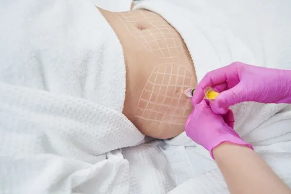 image of fat dissolving injections on love handles to help combat weight gain Uttoxeter