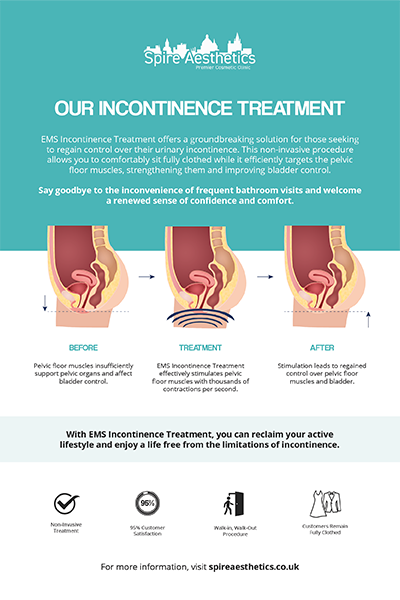 image of how urge incontinence Uttoxeter treatment works