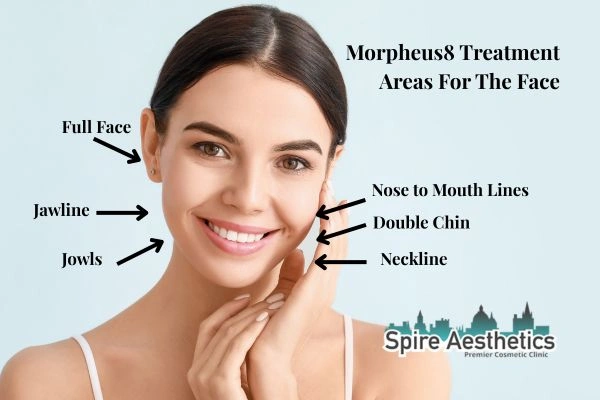 Where can Morpheus8 Treatment Uttoxeter be done on the body?