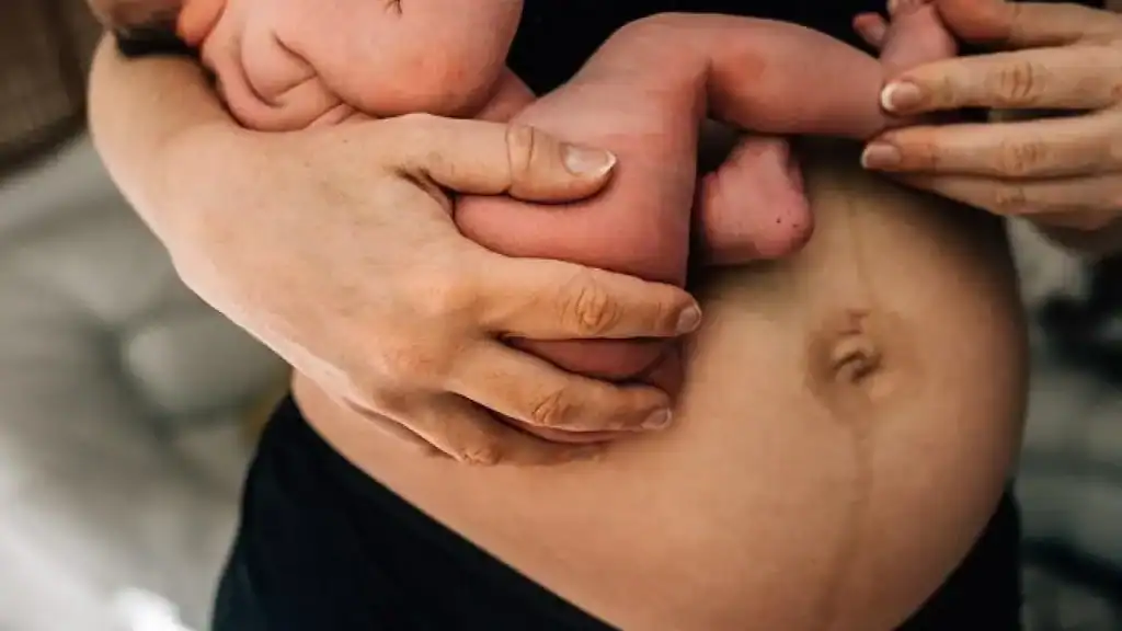 Why Is My Stomach Still Big After Pregnancy Uttoxeter?